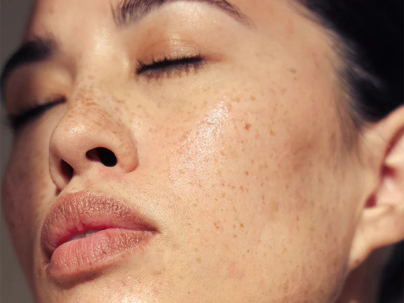 5 علاجات طبيعية لبشرتك حتى تقيها الجفاف في رمضان !          